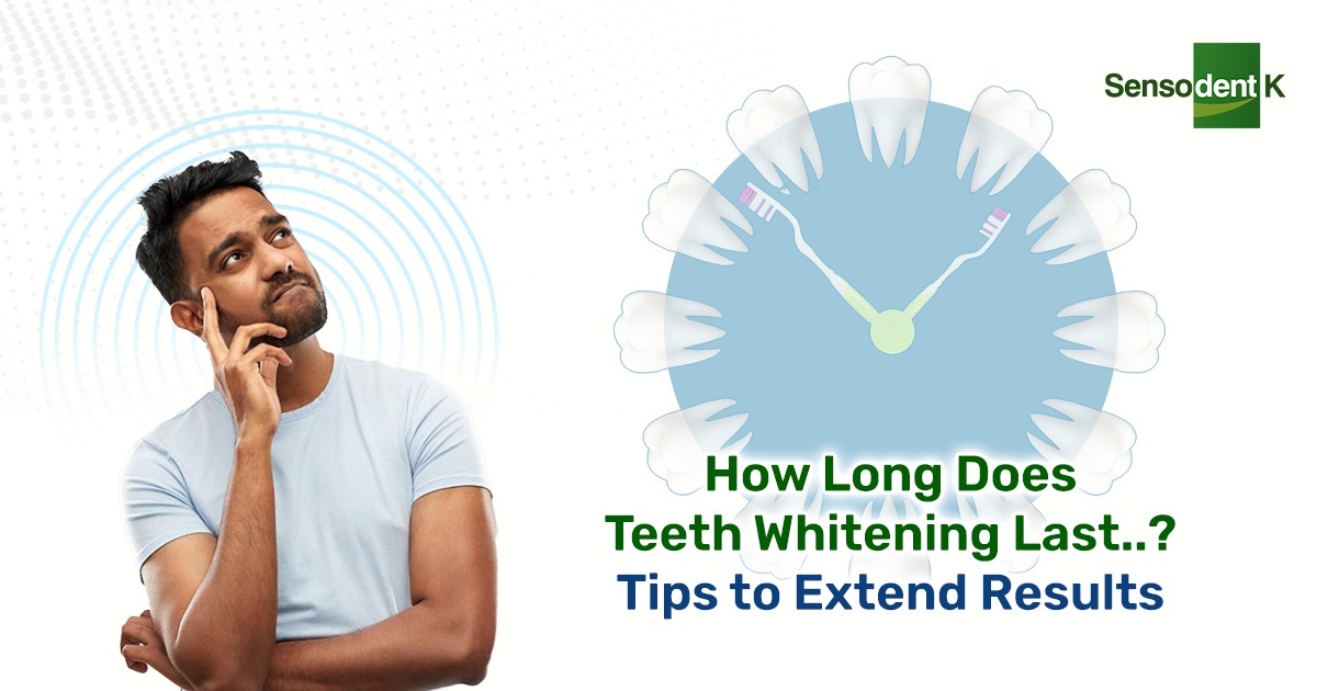 How Long Does Teeth Whitening Last