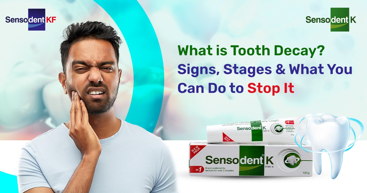 What is Tooth Decay