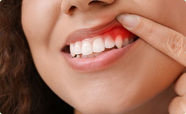 Difference between sensitive teeth and sensitive gum
