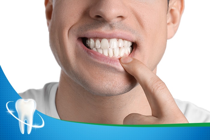 Signs that you are flossing too hard