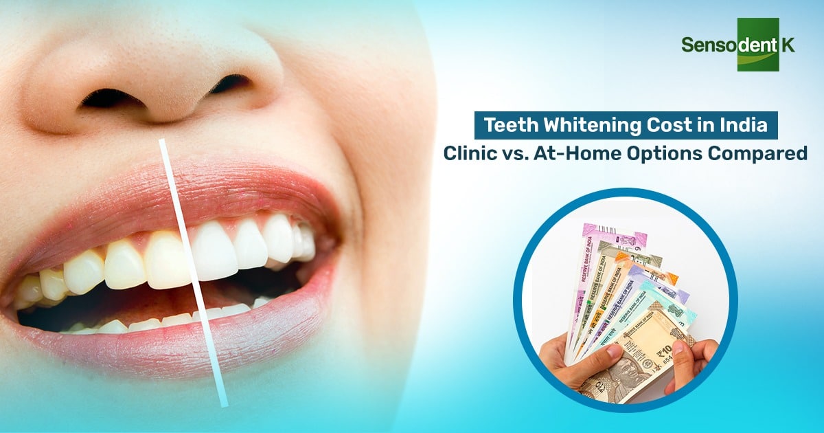 Teeth Whitening Cost in India