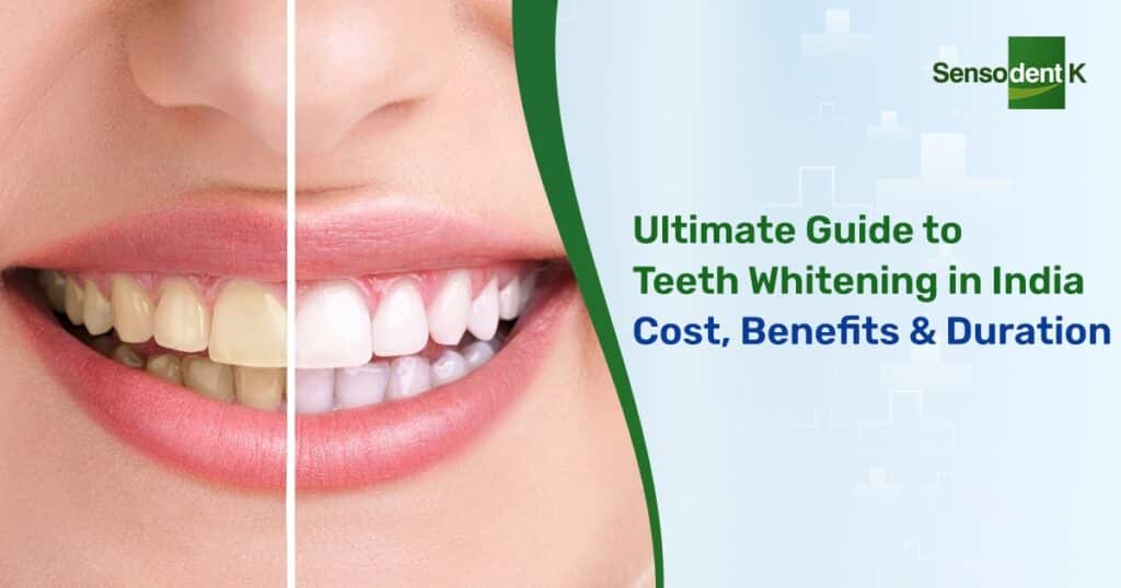 What is Teeth Whitening
