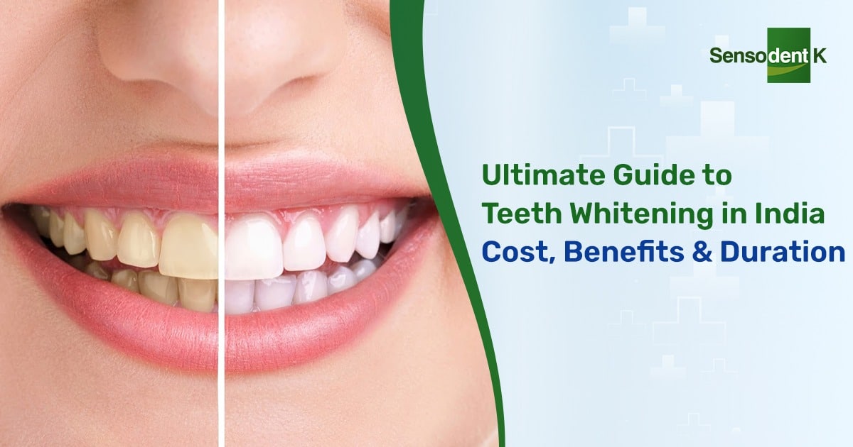 What is Teeth Whitening