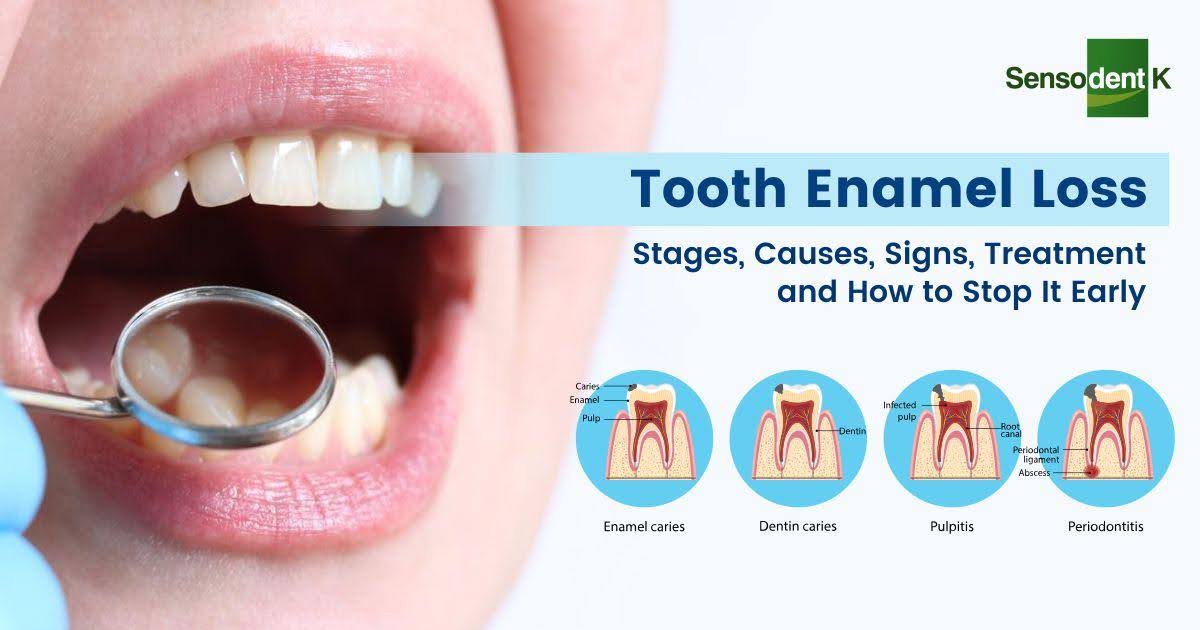 Tooth Enamel Loss